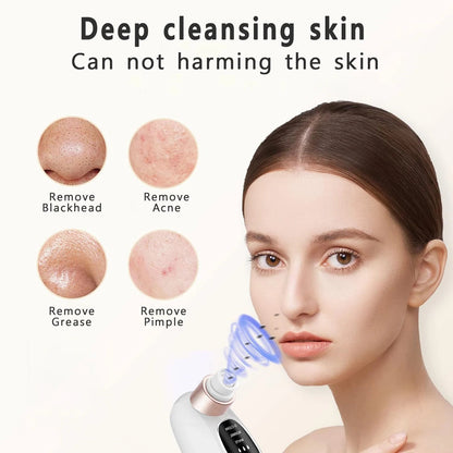 Pore Vacuum Cleaner Blackhead Remover